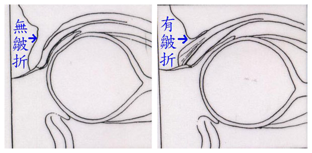 http://www.lrclinic.com.tw/upload/images/20170327153254.jpg