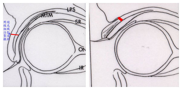 http://www.lrclinic.com.tw/upload/images/20170327153330.jpg