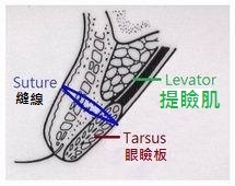 http://www.lrclinic.com.tw/upload/images/20170327153420.jpg